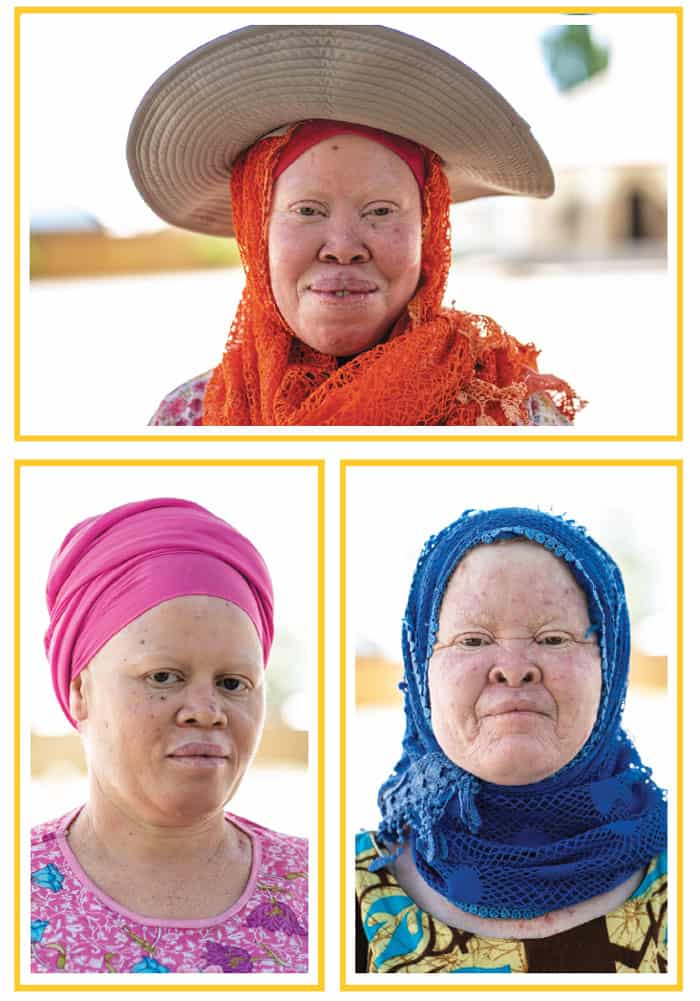 Zainabu Mangara, Amina Lameck and Adelina Muluge join a program for people living with albinism at St. Theresa of the Child Jesus Church in Dar es Salaam. (Gregg Brekke/Tanzania)
