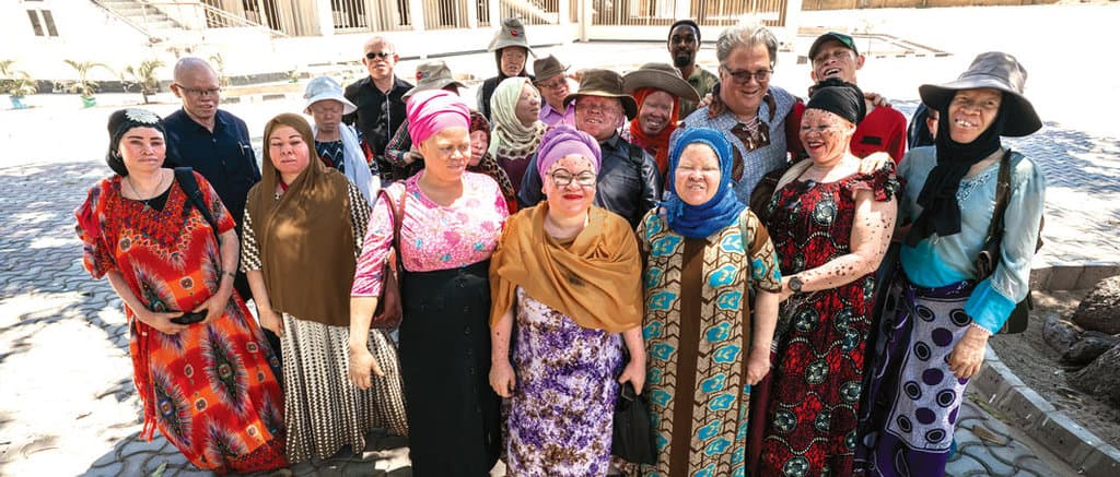 These Are God’s Children: Ministry for People with Albinism