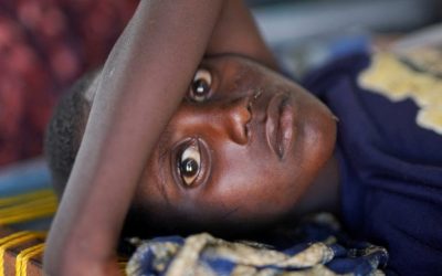 Cholera Outbreak Accelerates Hunger and Starvation in Sudan and South Sudan